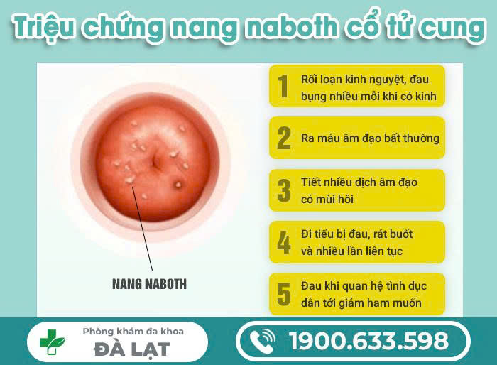 Hình ảnh minh họa